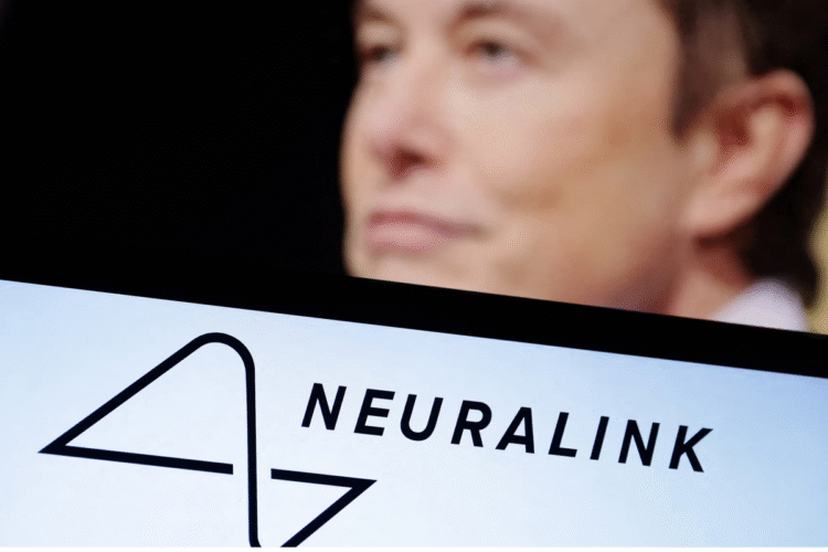 GILA! Elon Musk Bakal Produksi Ribuan Chip Otak Neuralink Mulai 2026