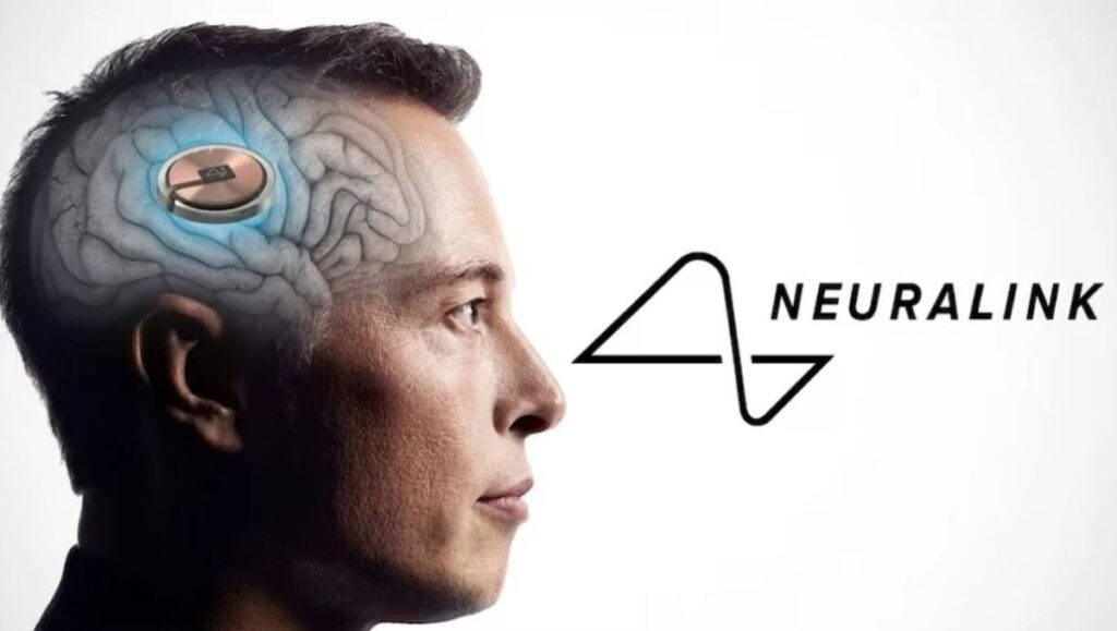 GILA! Elon Musk Bakal Produksi Ribuan Chip Otak Neuralink Mulai 2026