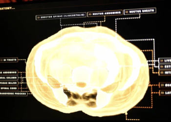 Midjourney Kembangkan Pemindai Tubuh Ultrasonik, Diklaim 100 Kali Lebih Cepat dari MRI